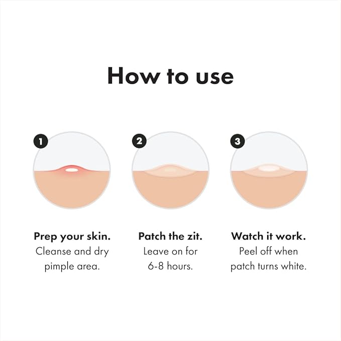 Mighty Patch Original – Hydrocolloid Acne Patches, 36 Ct.